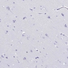Immunohistochemical staining of human cerebral cortex shows no positivity in neurons as expected.