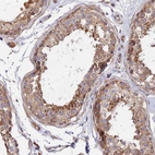 Immunohistochemical staining of human testis shows moderate to strong cytoplasmic positivity in cells in seminiferous ducts.