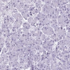 Immunohistochemical staining of human pancreas shows no positivity in exocrine glandular cells as expected.
