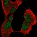 Immunofluorescent staining of human cell line SH-SY5Y shows localization to nucleoplasm.