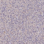 Immunohistochemical staining of human pancreas shows no cytoplasmic positivity in exocrine glandular cells as expected.
