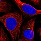 Immunofluorescent staining of human cell line U-2 OS shows localization to vesicles.