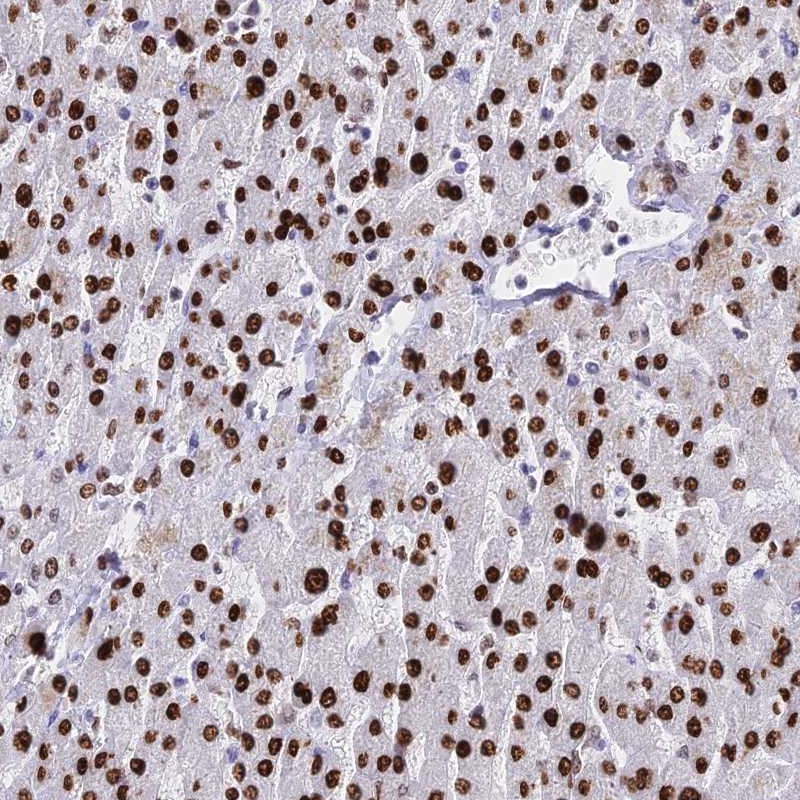 Anti-HIST1H1A Antibody