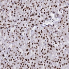 Anti-HIST1H1A Antibody