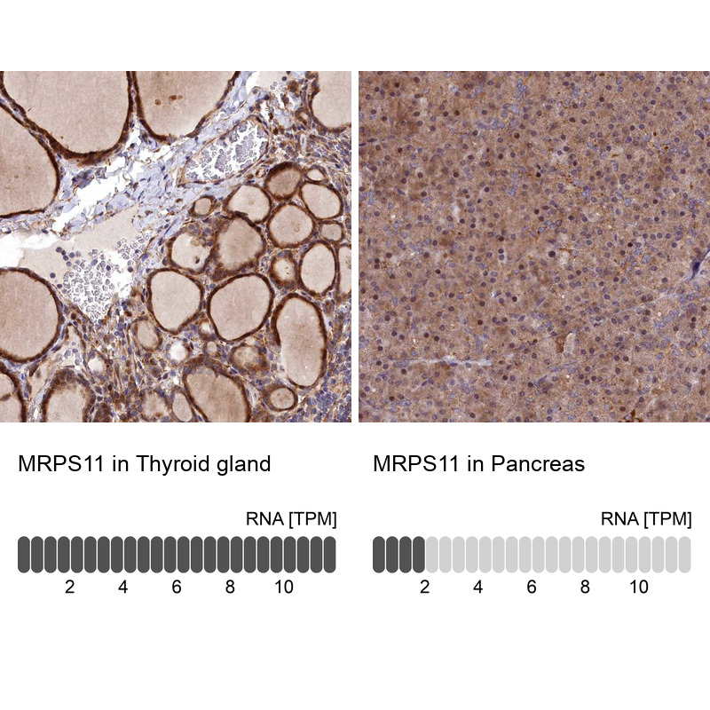 Anti-MRPS11 Antibody