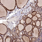Immunohistochemical staining of human thyroid gland shows high expression.