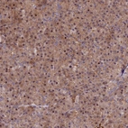 Immunohistochemical staining of human pancreas shows low expression as expected.