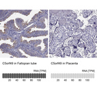 Anti-C5orf49 Antibody