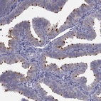 Immunohistochemical staining of human fallopian tube shows high expression.