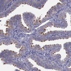 Anti-C5orf49 Antibody