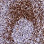 Anti-PRPS1 Antibody