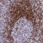 Anti-PRPS1 Antibody