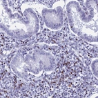 Immunohistochemical staining of human endometrium shows moderate nuclear positivity in stromal cells.