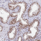 Immunohistochemical staining of human prostate shows moderate to strong nuclear positivity in glandular cells.