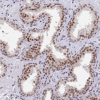 Immunohistochemical staining of human prostate shows moderate to strong nuclear positivity in glandular cells.