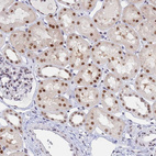 Immunohistochemical staining of human kidney shows moderate to strong nuclear positivity in cells in tubules.