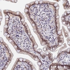 Immunohistochemical staining of human small intestine shows moderate nuclear positivity in glandular cells.