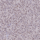 Immunohistochemical staining of human pancreas shows nuclear positivity.