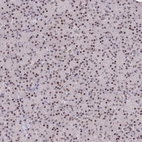 Immunohistochemical staining of human pancreas shows nuclear positivity.