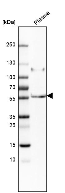 Anti-PI16 Antibody