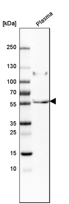 Anti-PI16 Antibody