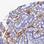 Immunohistochemical staining of human small intestine shows moderate membranous positivity in glandular cells.