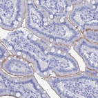 Immunohistochemical staining of human duodenum shows weak membranous positivity in glandular cells.