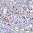 Immunohistochemical staining of human kidney shows moderate membranous positivity in cells in tubules.