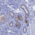 Immunohistochemical staining of human endometrium shows strong membranous positivity in glandular cells.