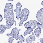 Immunohistochemical staining of human placenta shows no positivity in trophoblastic cells.