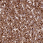 Anti-C5orf51 Antibody
