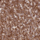 Anti-C5orf51 Antibody