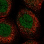 Immunofluorescent staining of human cell line A-431 shows localization to nucleoplasm & cytosol.