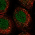 Immunofluorescent staining of human cell line A-431 shows localization to nucleoplasm & cytosol.