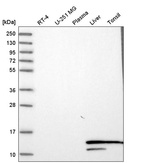 Western blot analysis in human cell line RT-4, human cell line U-251 MG, human plasma, human liver tissue and human tonsil tissue.