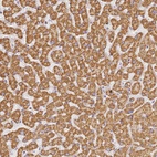Immunohistochemical staining of human liver shows strong granular cytoplasmic positivity in hepatocytes.