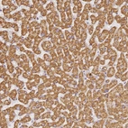 Immunohistochemical staining of human liver shows strong granular cytoplasmic positivity in hepatocytes.