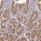Immunohistochemical staining of human duodenum shows strong granular cytoplasmic positivity in glandular cells.