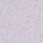 Immunohistochemical staining of human skeletal muscle shows no positivity as expected.
