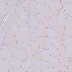 Immunohistochemical staining of human skeletal muscle shows no positivity as expected.