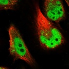 Immunofluorescent staining of human cell line U-251 MG shows localization to nucleoplasm & vesicles.