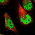 Immunofluorescent staining of human cell line U-251 MG shows localization to nucleoplasm & vesicles.