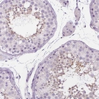 Immunohistochemical staining of human testis shows high expression.