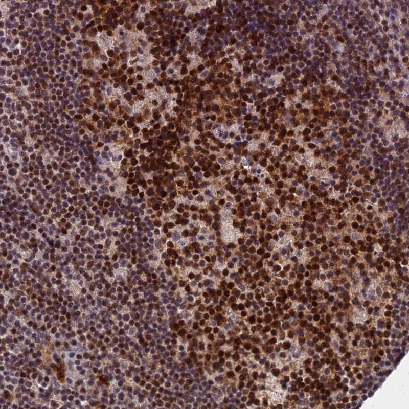Anti-TCEA1 Antibody