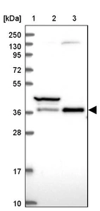 Lane 1: Marker [kDa] 250, 130, 95, 72, 55, 36, 28, 17, 10_br/_Lane 2: Human cell line RT-4_br/_Lane 3: Human cell line U-251MG sp