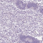 Anti-DCAF8L1 Antibody