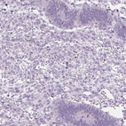 Immunohistochemical staining of human endometrium shows low expression as expected.