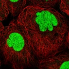 Immunofluorescent staining of human cell line A-431 shows localization to nucleus.
