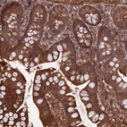 Anti-FCHSD1 Antibody