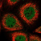 Immunofluorescent staining of human cell line A-431 shows localization to nucleoplasm & cytosol.